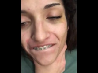 Young brace face showing her wet tongue (PREVIEW)